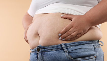 Kiterjesztett lipid panel